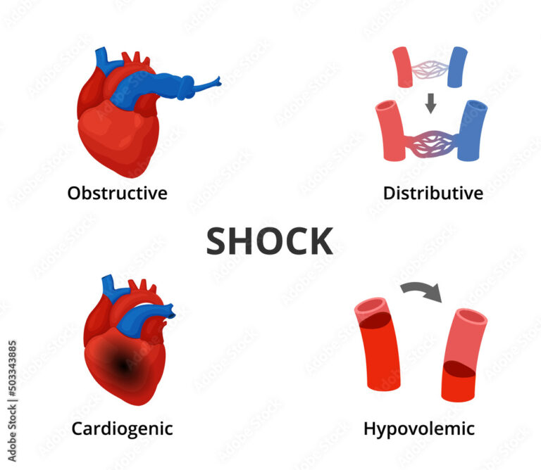 Shock Brands For Cars: A Comprehensive Guide to Choosing the Right Ride